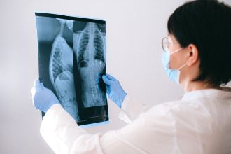 Profissional de saúde usando máscara e luvas examina uma radiografia do tórax em ambiente clínico.