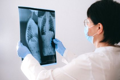 Profissional de saúde usando máscara e luvas examina uma radiografia do tórax em ambiente clínico.