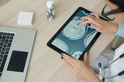 Profissional de saúde examina imagens de ressonância magnética do cérebro em um tablet.