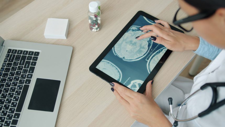 Profissional de saúde examina imagens de ressonância magnética do cérebro em um tablet.