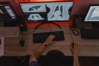 Radiologista analisa exames de raios X em vários monitores durante um procedimento de diagnóstico médico.